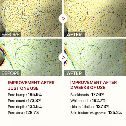 KLENZIA™ White & Black Rice Renewal Duo